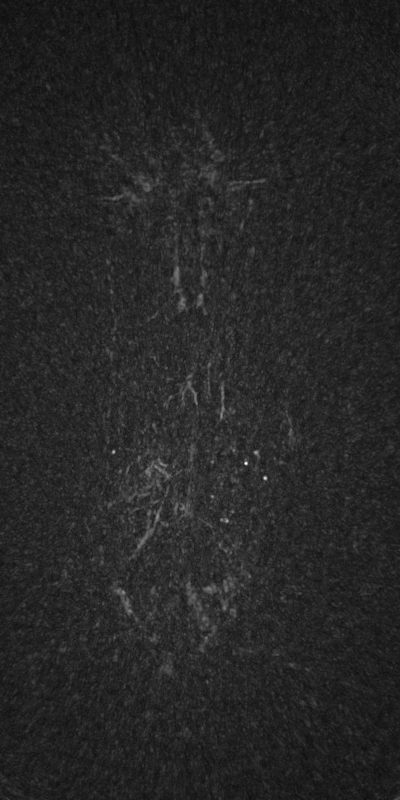 Detail from the before image